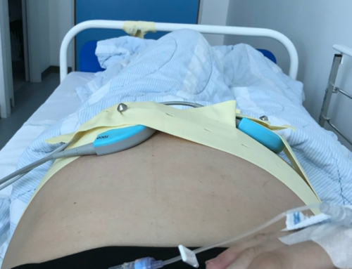 My own birth story